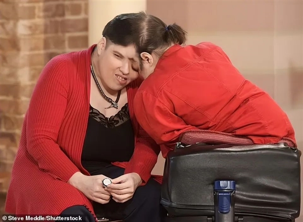 奇趣分分彩:美国最年长连体人62岁去世:妹妹46岁变性 支持姐姐结婚生子